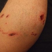 tips to prevent dog bites in maine