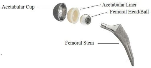 hip replacement prostheses